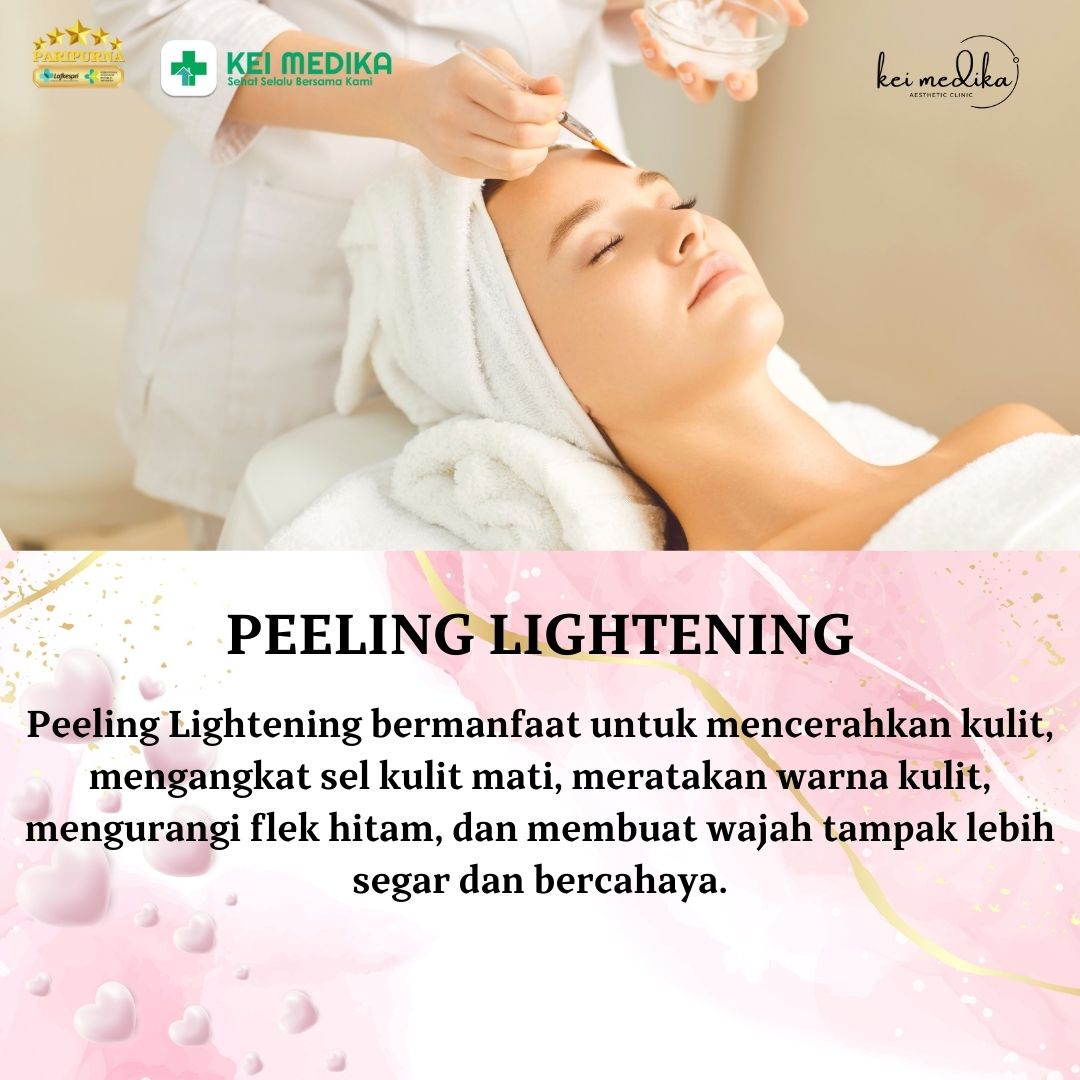 PEELING LIGHTENING
