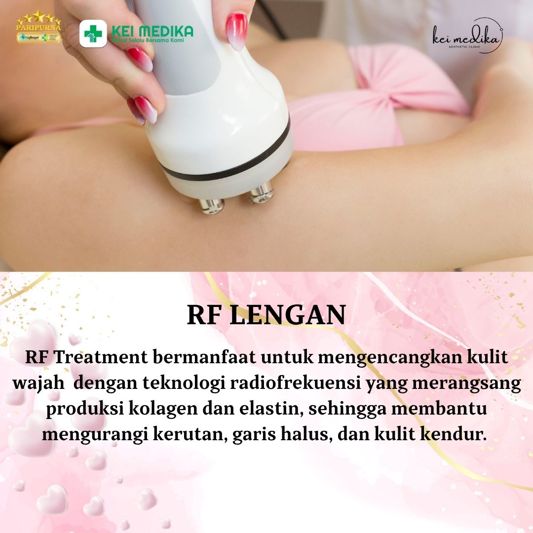 RF LENGAN