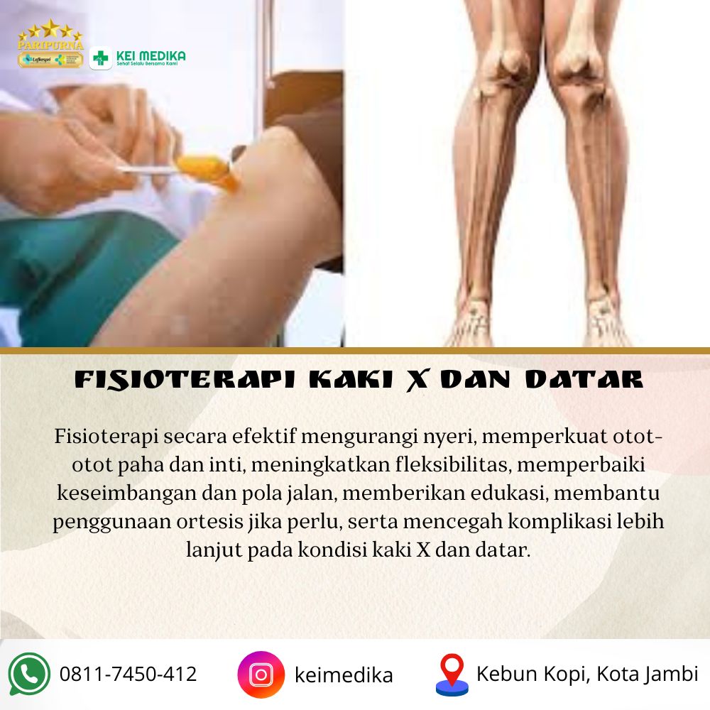 KAKI X + DATAR 12 SESI 