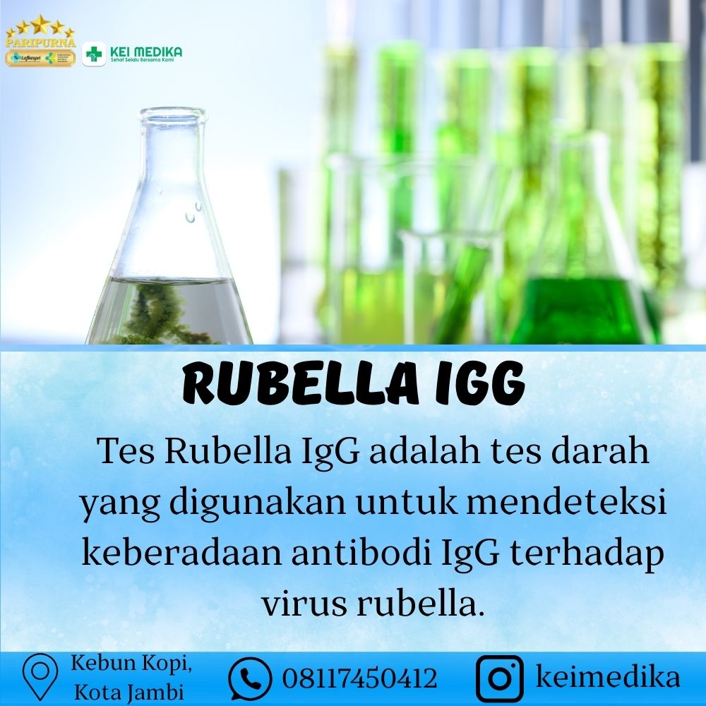 RUBELLA IGG