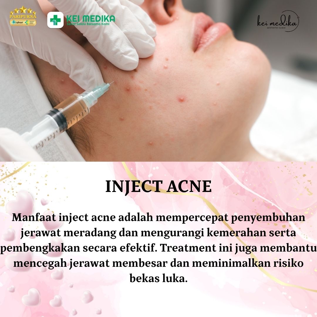 INJEKSI ACNE