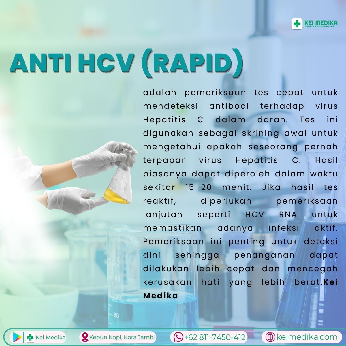 ANTI HCV ( RAPID)