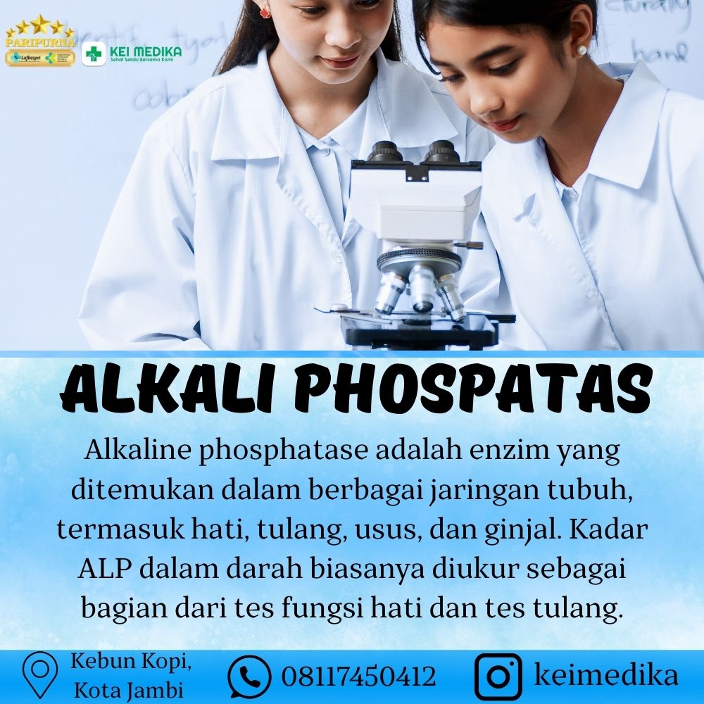 ALKALI PHOSPATASE