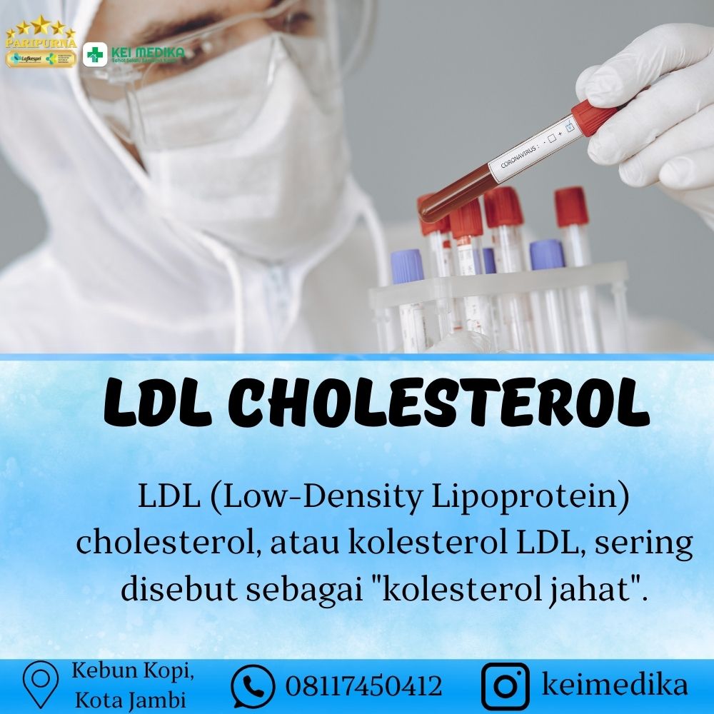 LDL CHOLESTEROL