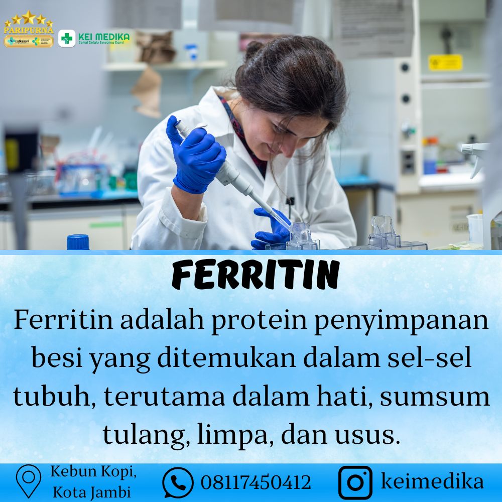 FERRITIN
