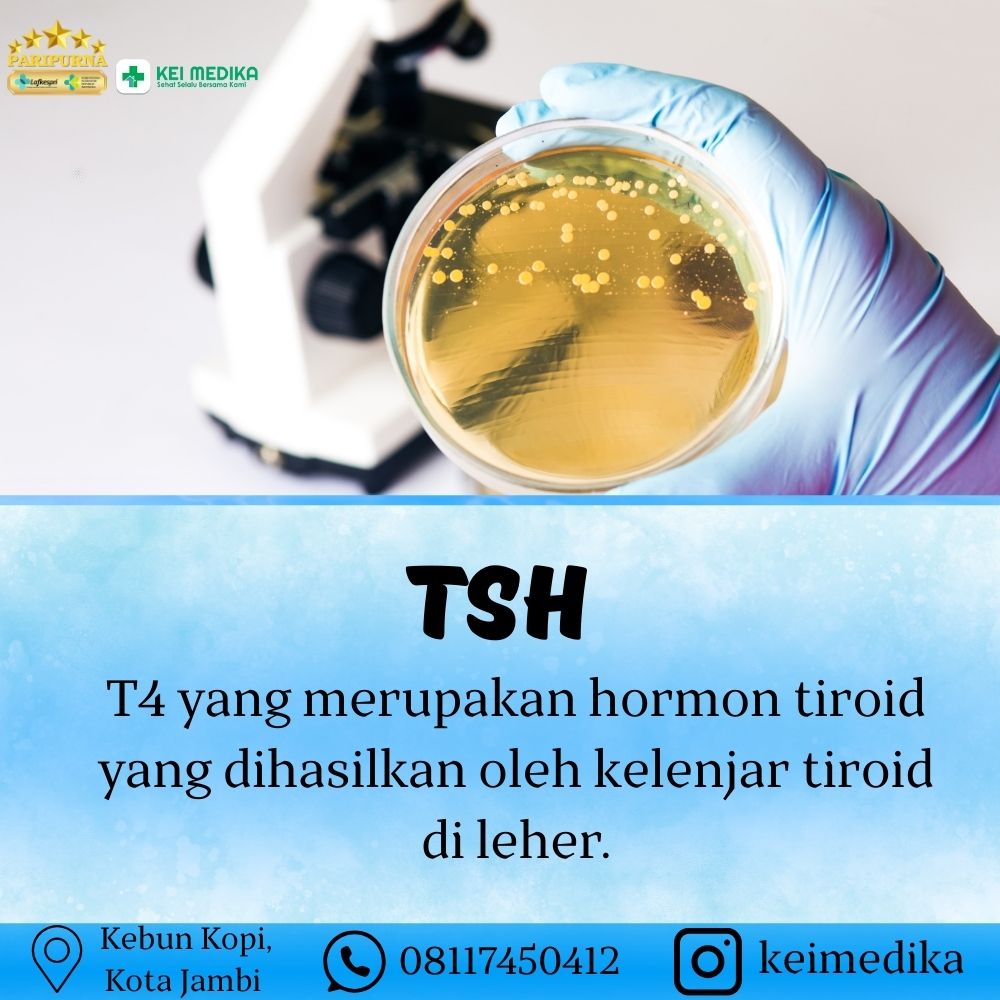 TSH 