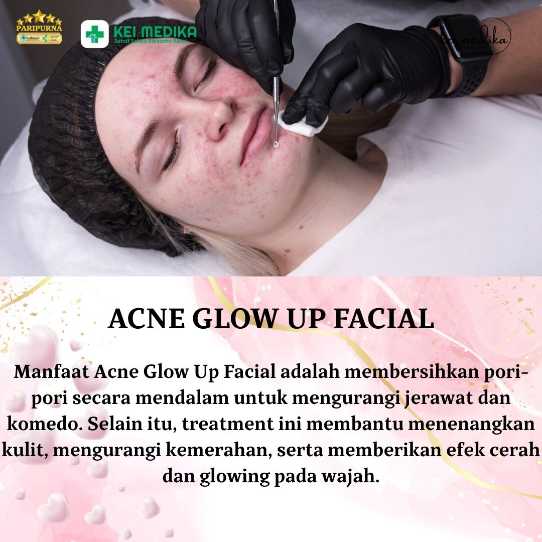 ACNE GLOW UP FACIAL