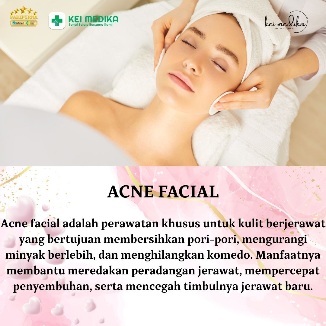 ACNE FACIAL 