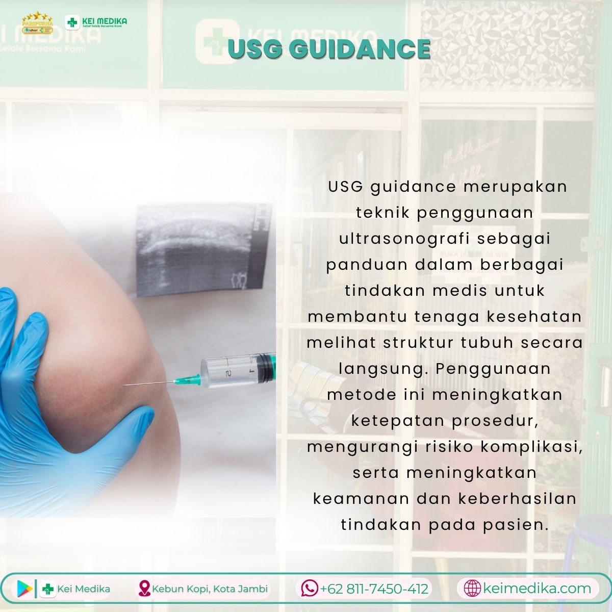 USG GUIDANCE 
