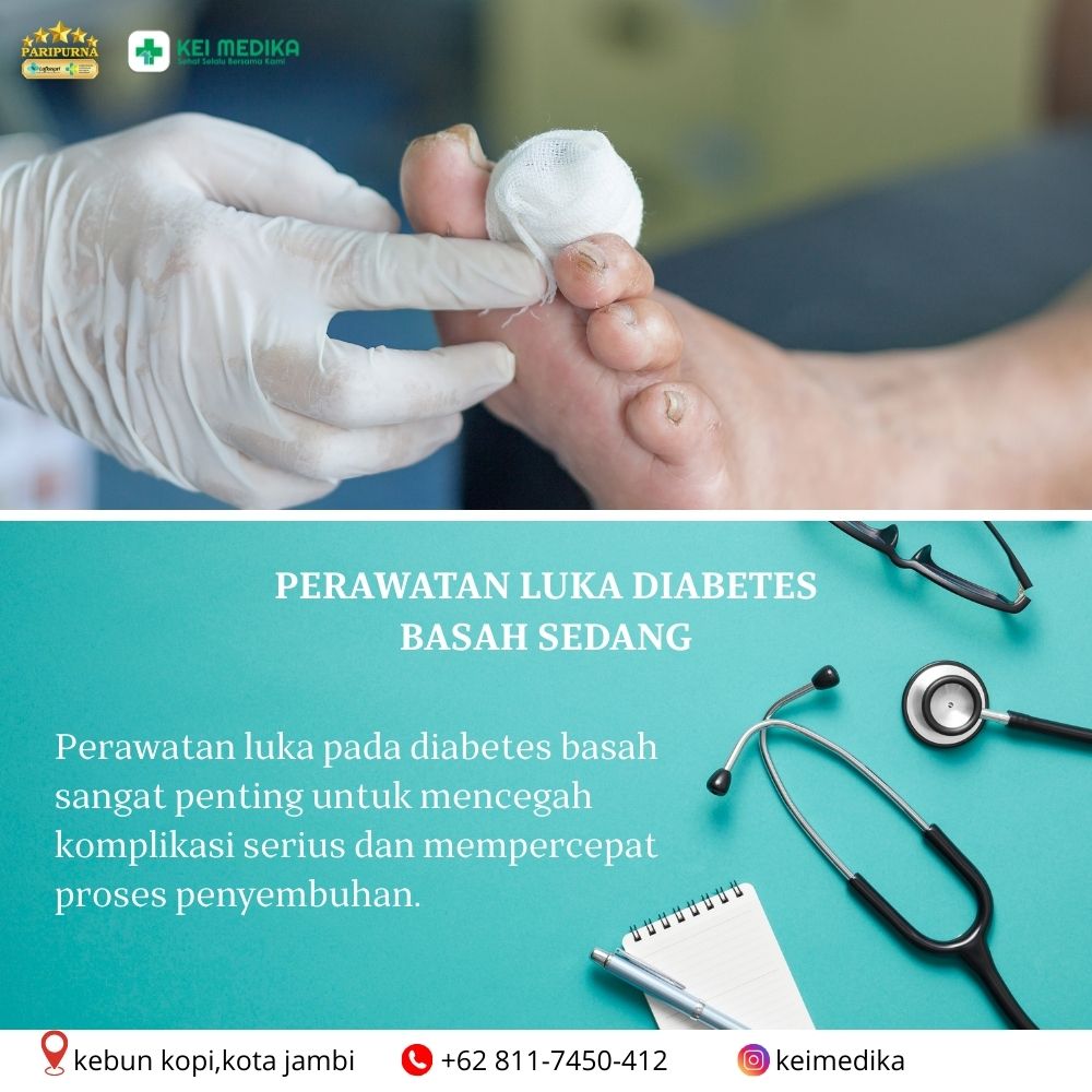  PERAWATAN LUKA DIABETES BASAH SEDANG 
