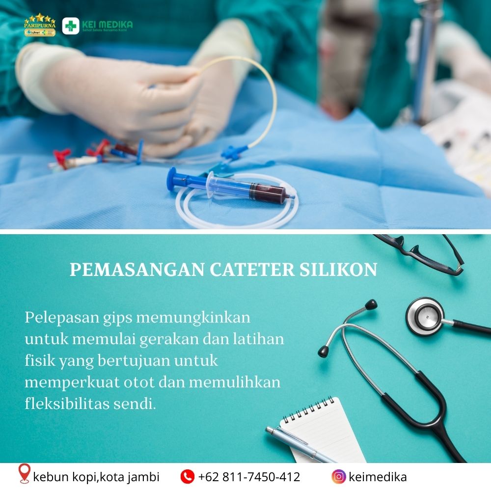 CATETER SILIKON 