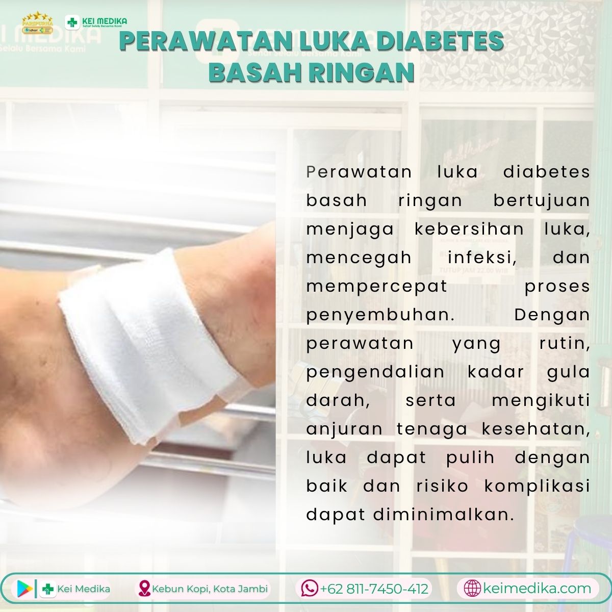  PERAWATAN LUKA DIABETES BASAH RINGAN