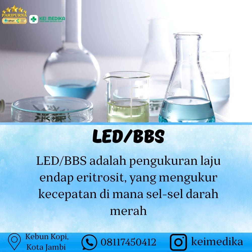 LED/BBS
