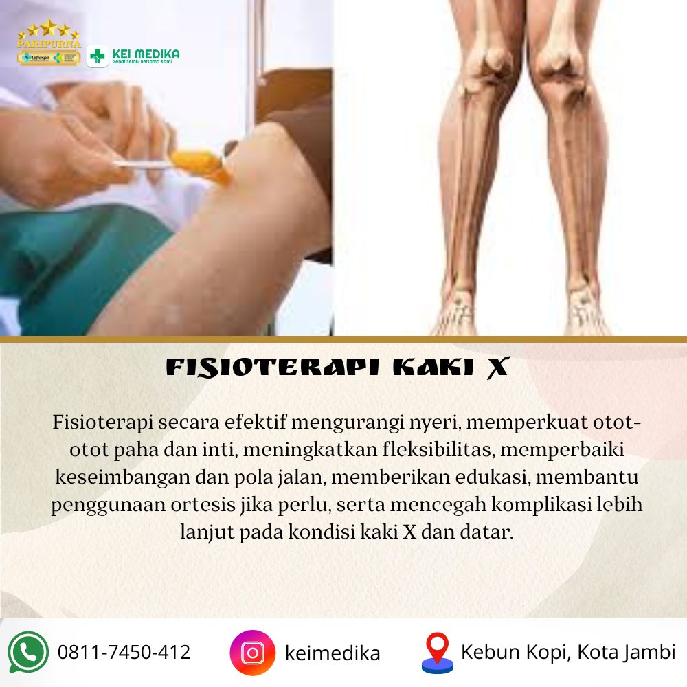 FISIOTERAPI KAKI X 1 SESI