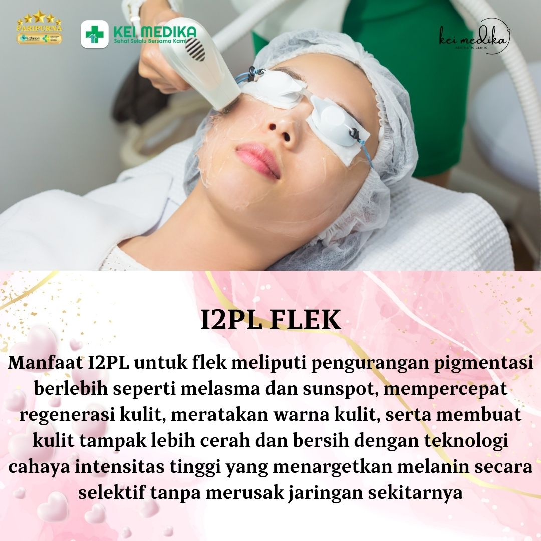 I2PL FLEK