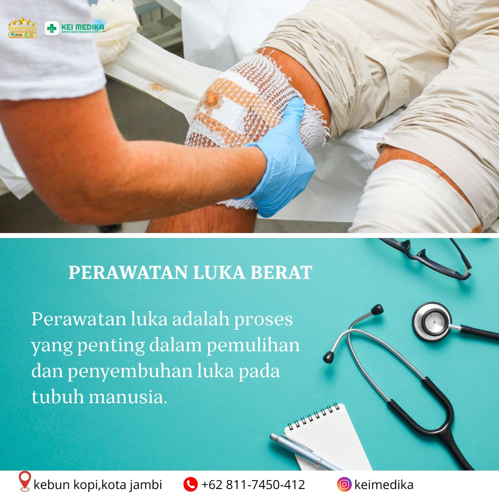 PERAWATAN LUKA BERAT 