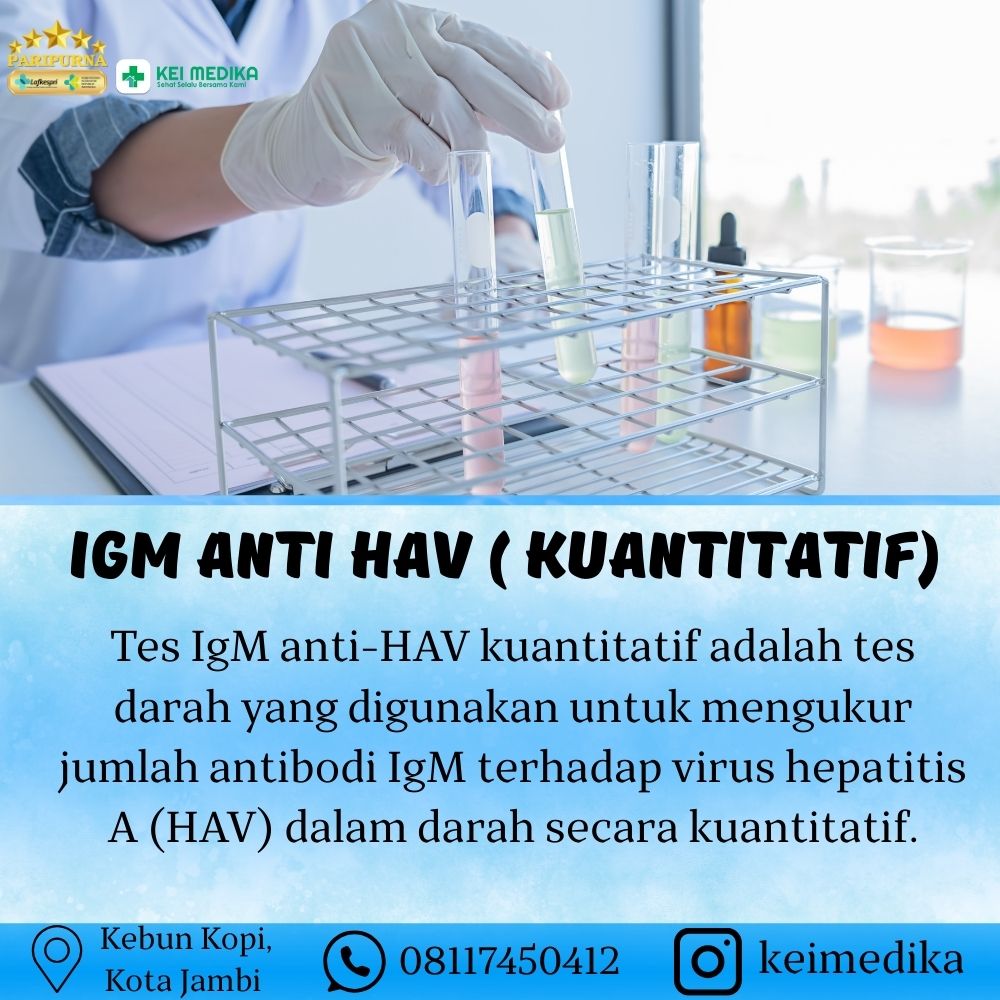 IGM ANTI HAV ( KUANTITATIF)