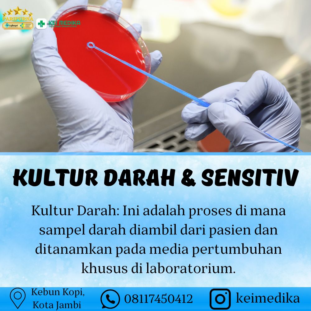 KULTUR DARAH & SENSITIV
