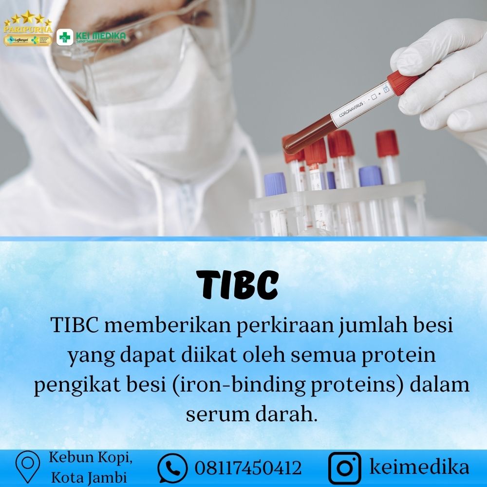 TIBC