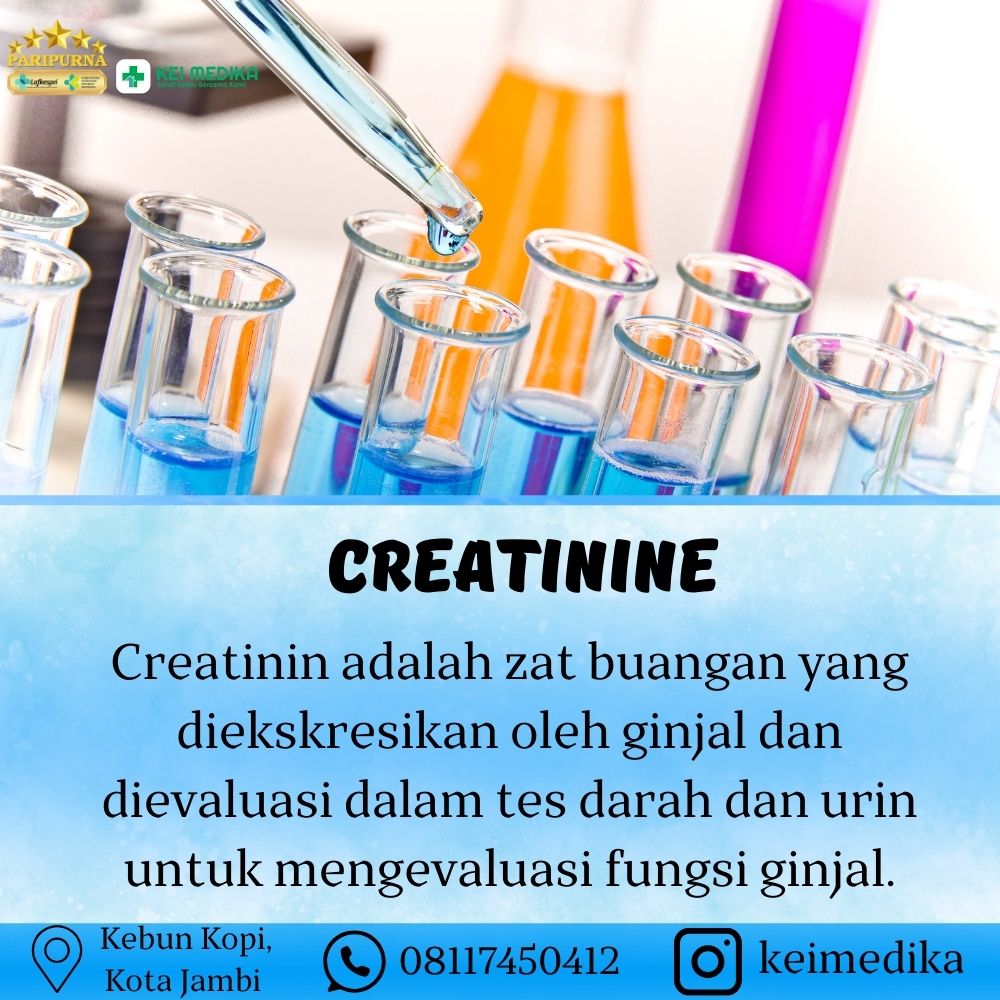 CREATININE