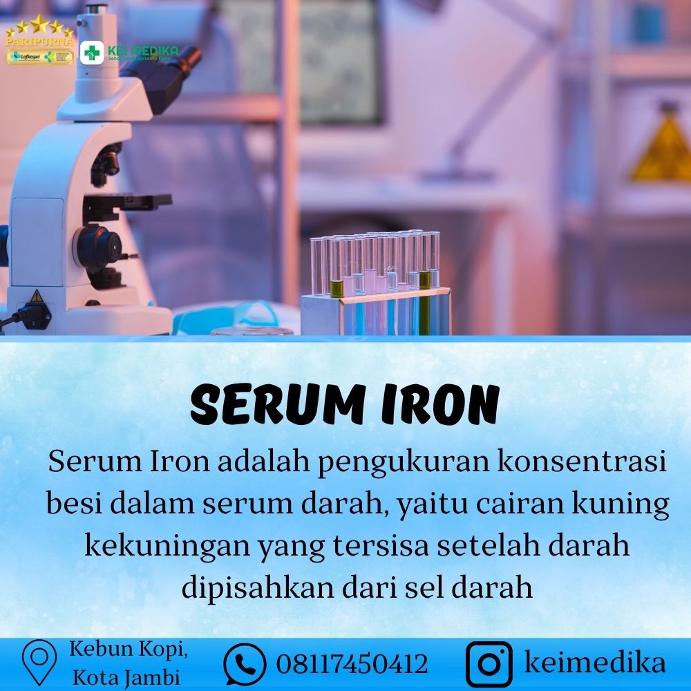 SERUM IRON