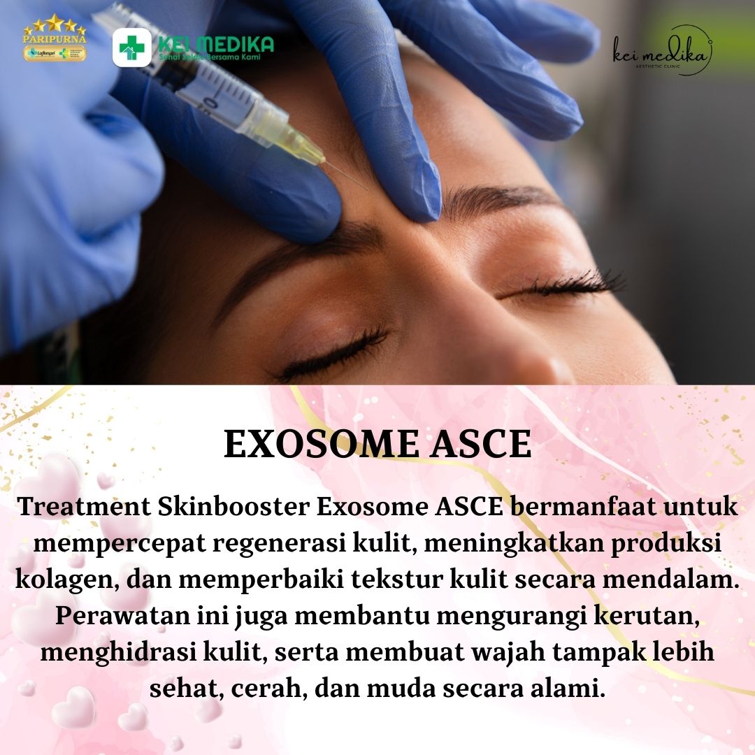 EXOSOME ASCE