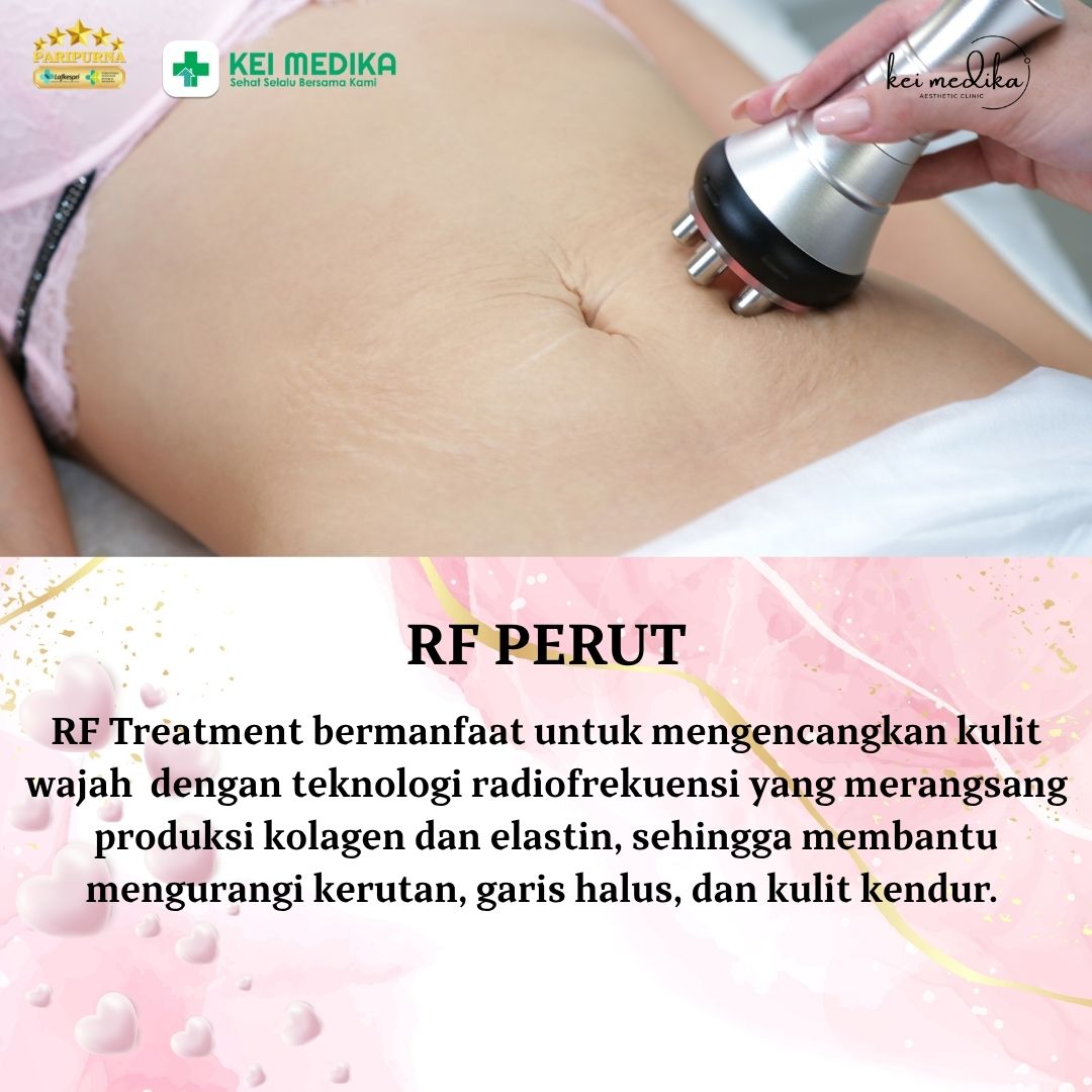 RF PERUT