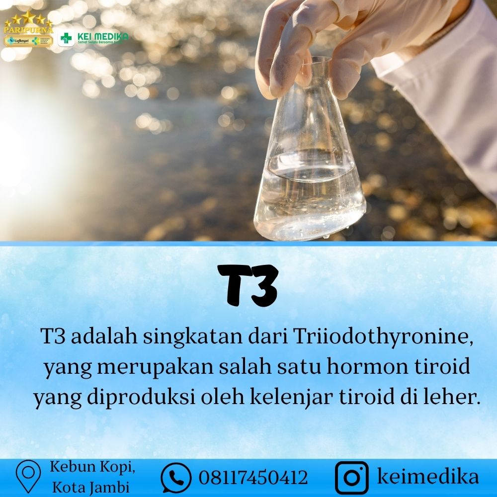 T3