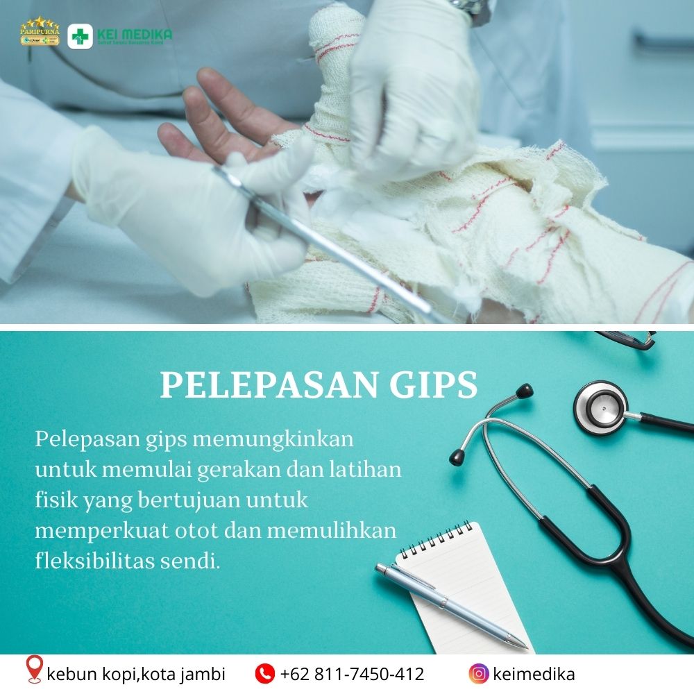 PELEPASAN GIPS