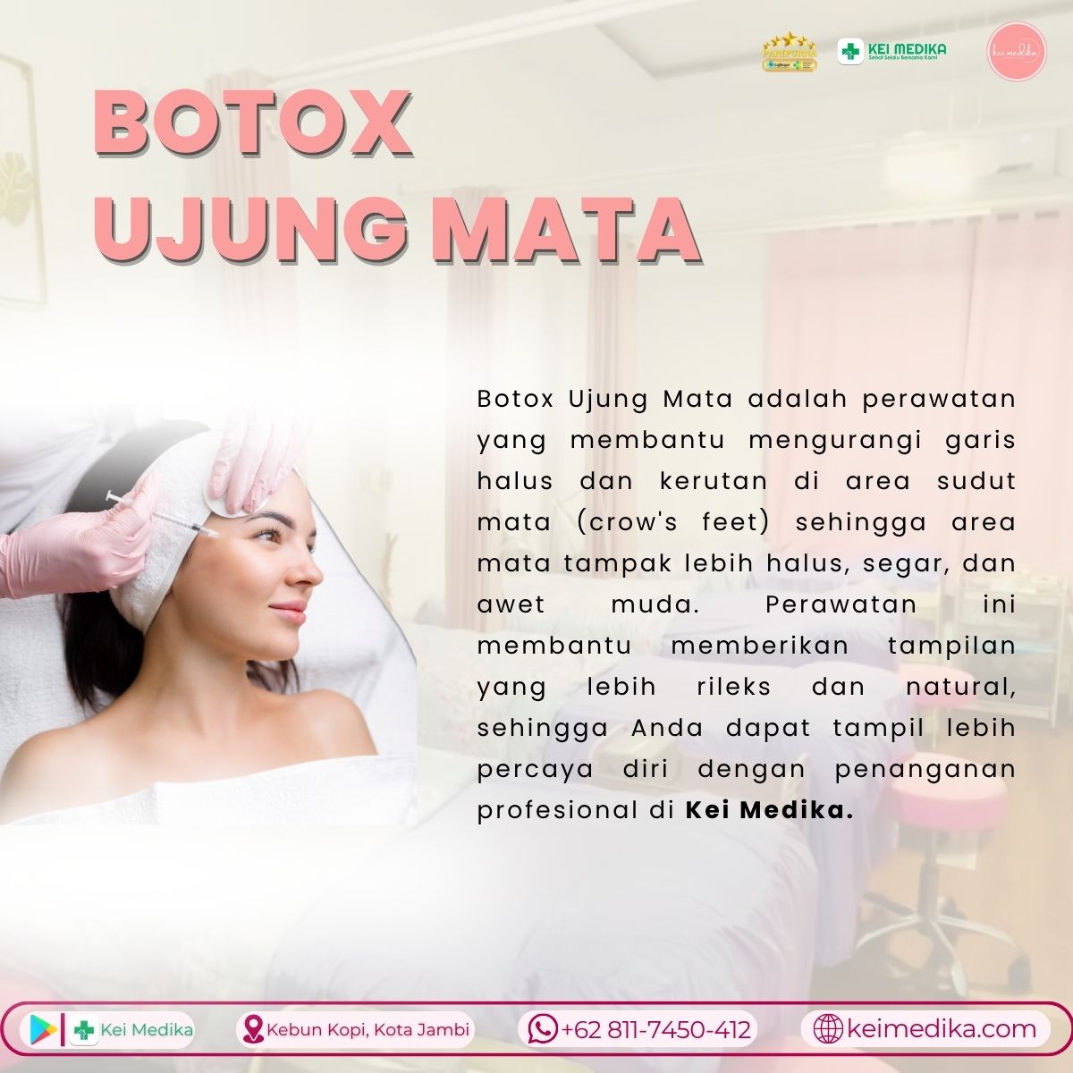 BOTOX UJUNG MATA