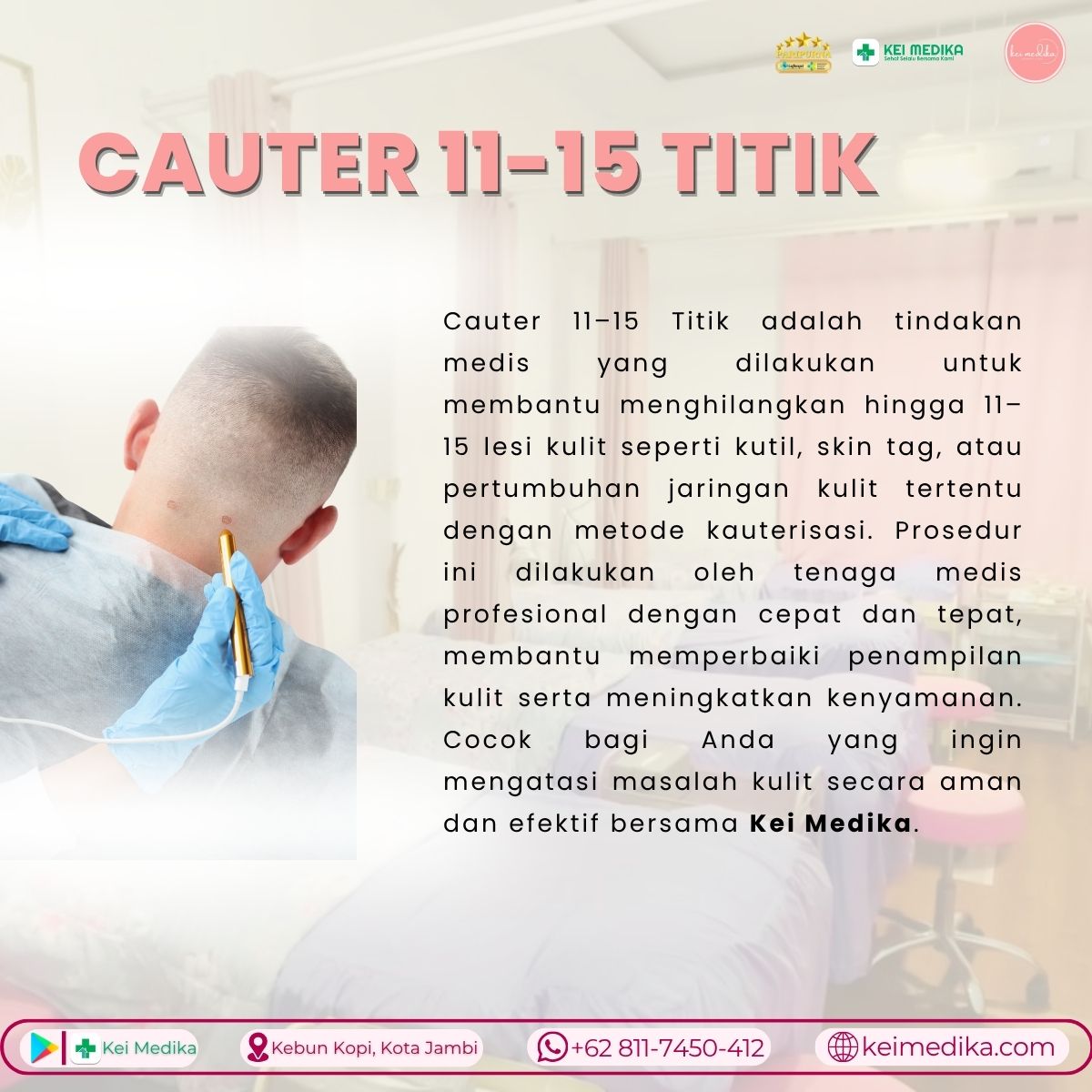 CAUTER 11-15 TITIK