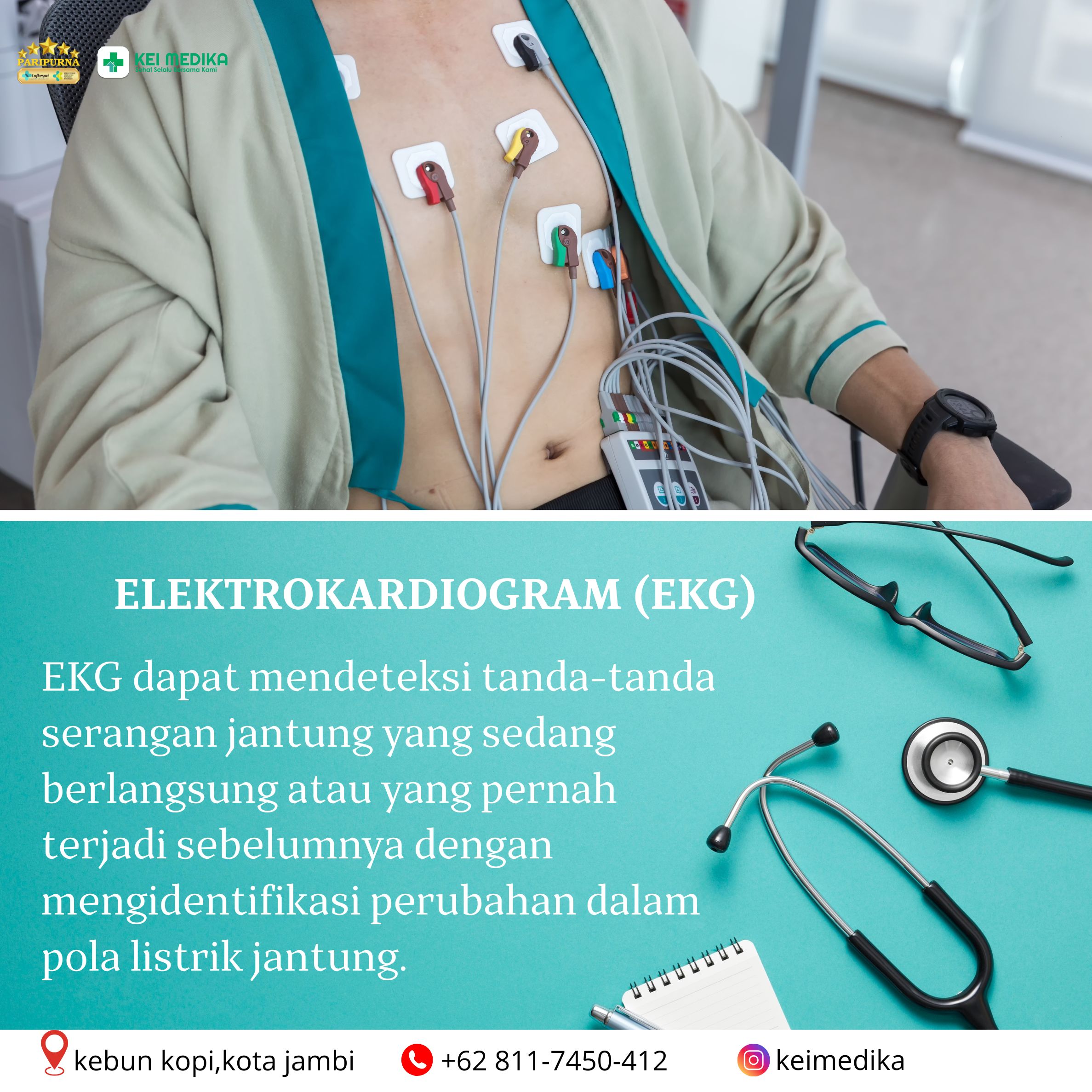 ELEKTROKARDIOGRAM  (EKG) 