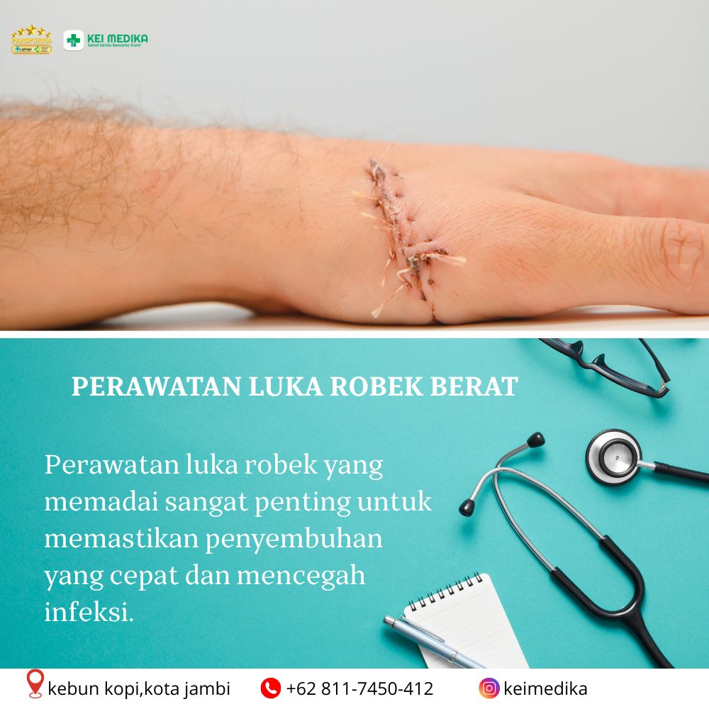 PERAWATAN LUKA ROBEK BERAT