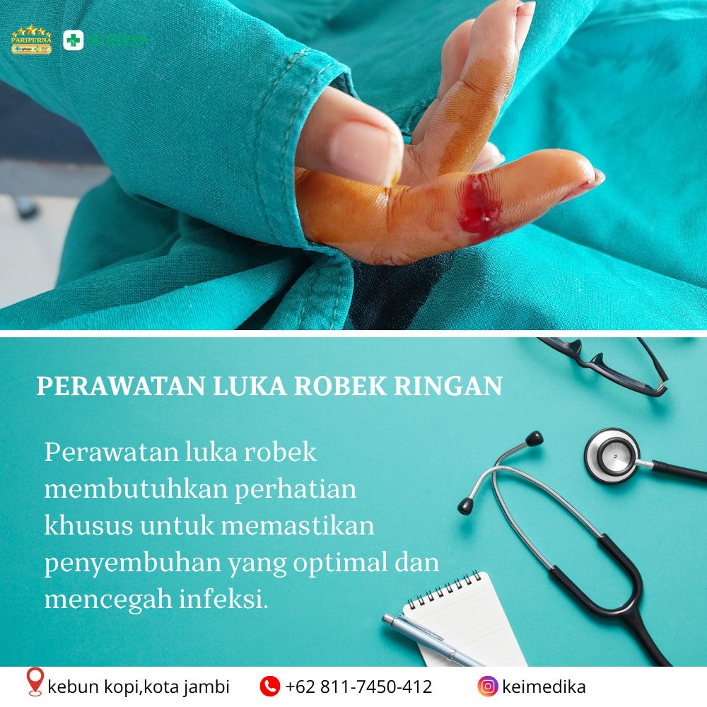 PERAWATAN LUKA RINGAN 