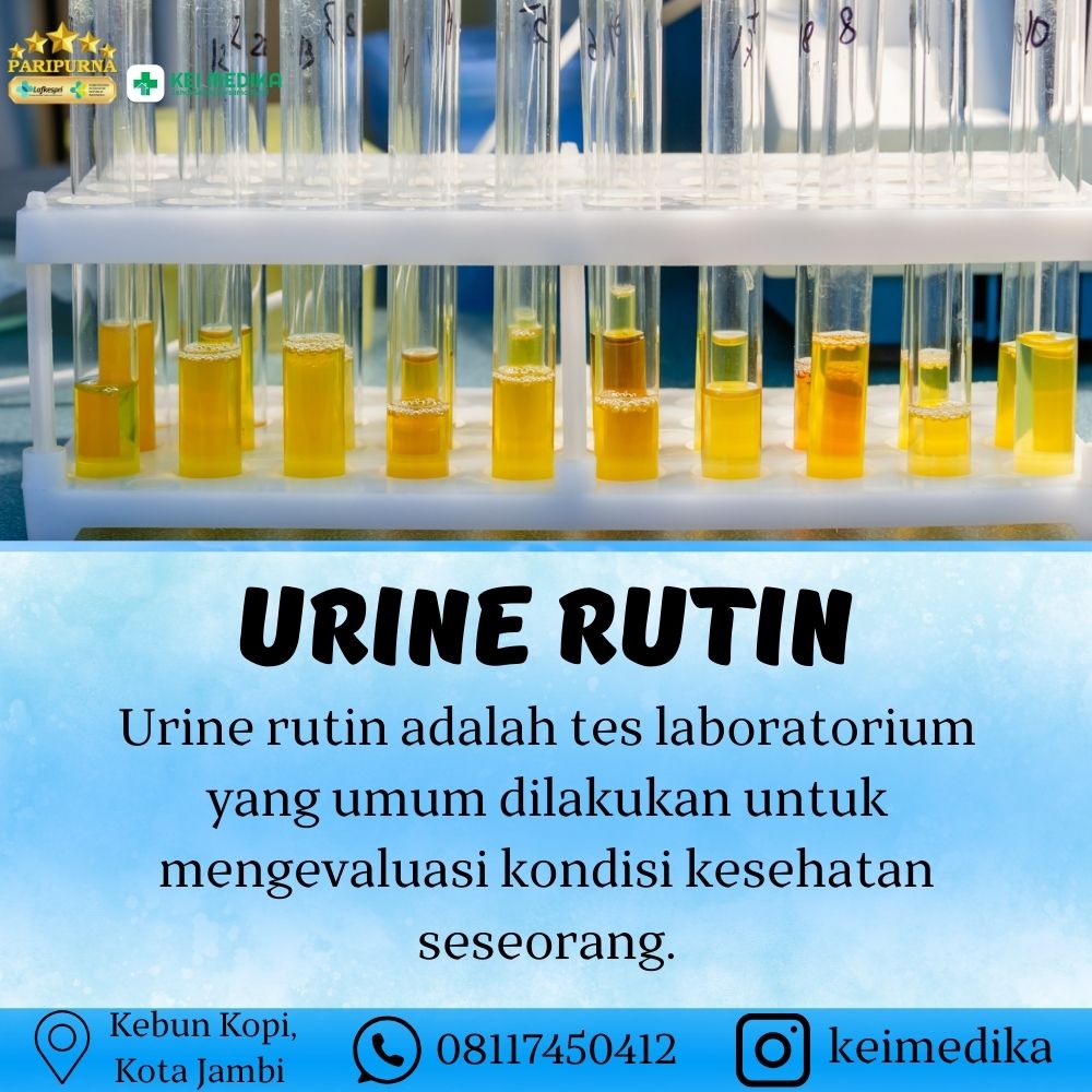 URINE RUTIN 