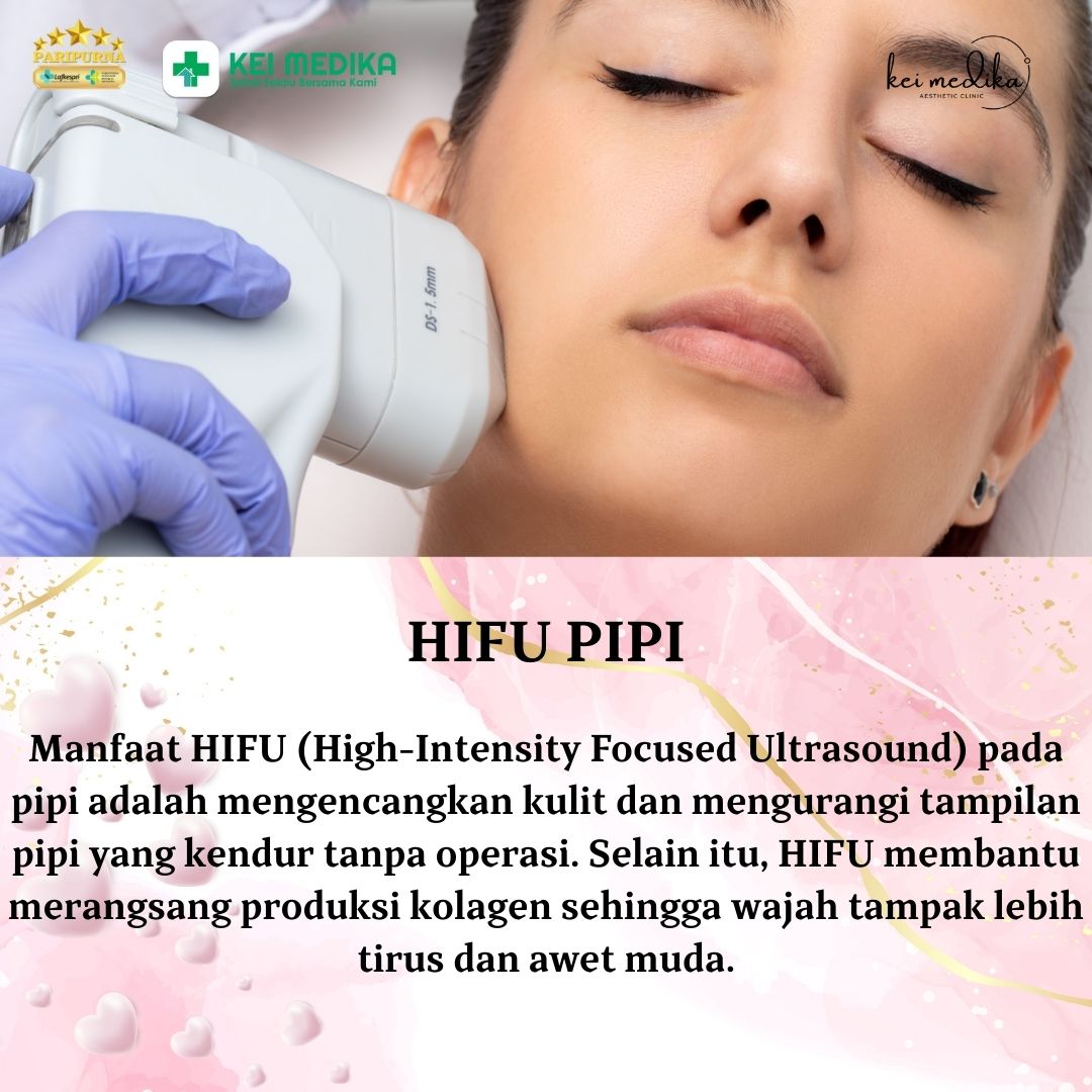 HIFU PIPI