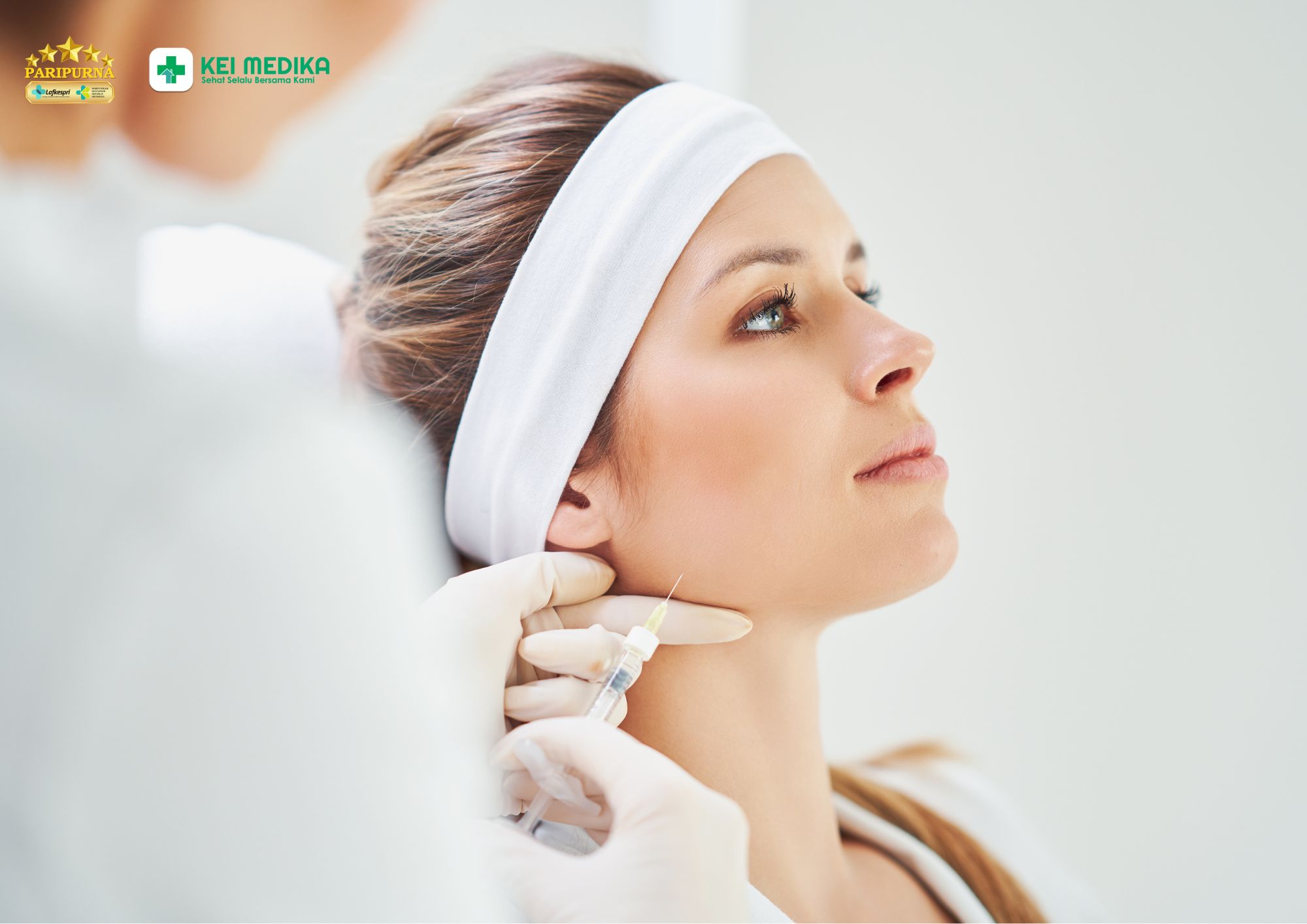 Manfaat botox untuk menyamarkan garis senyum