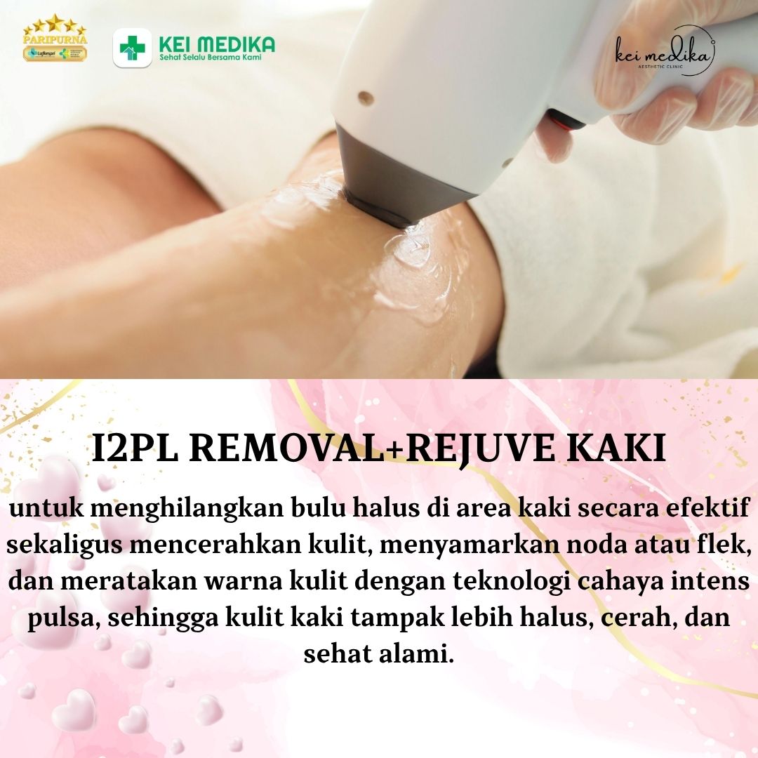 I2PL REMOVAL+REJUVE KAKI