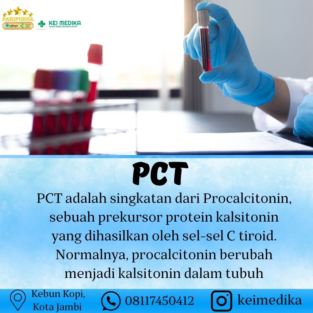 PCT 