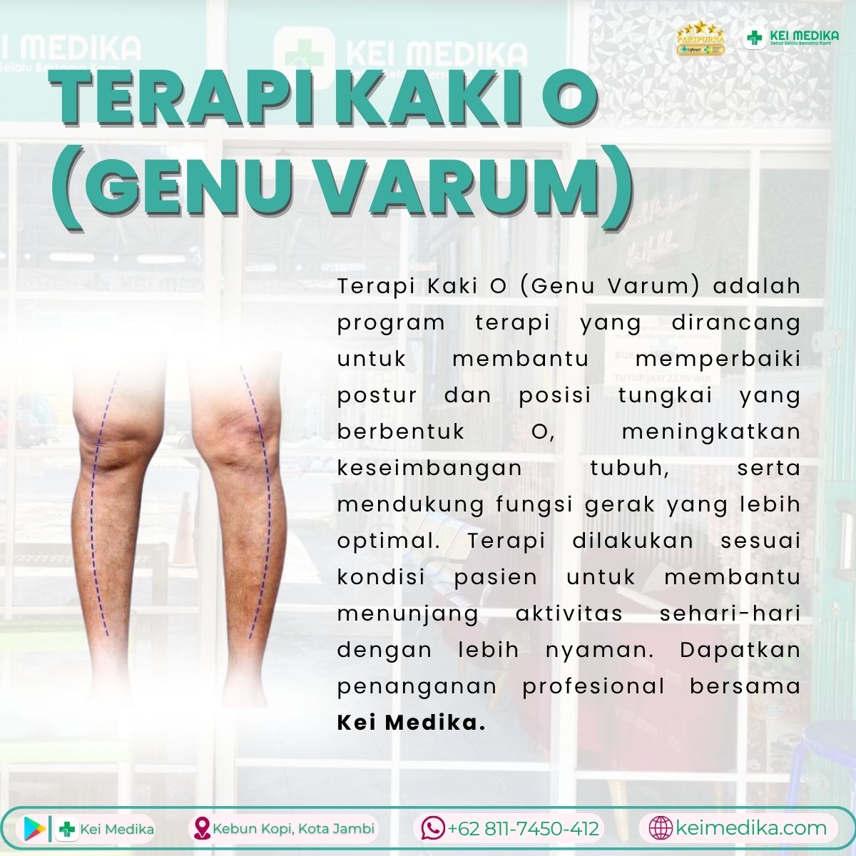 KAKI O 1 SESI
