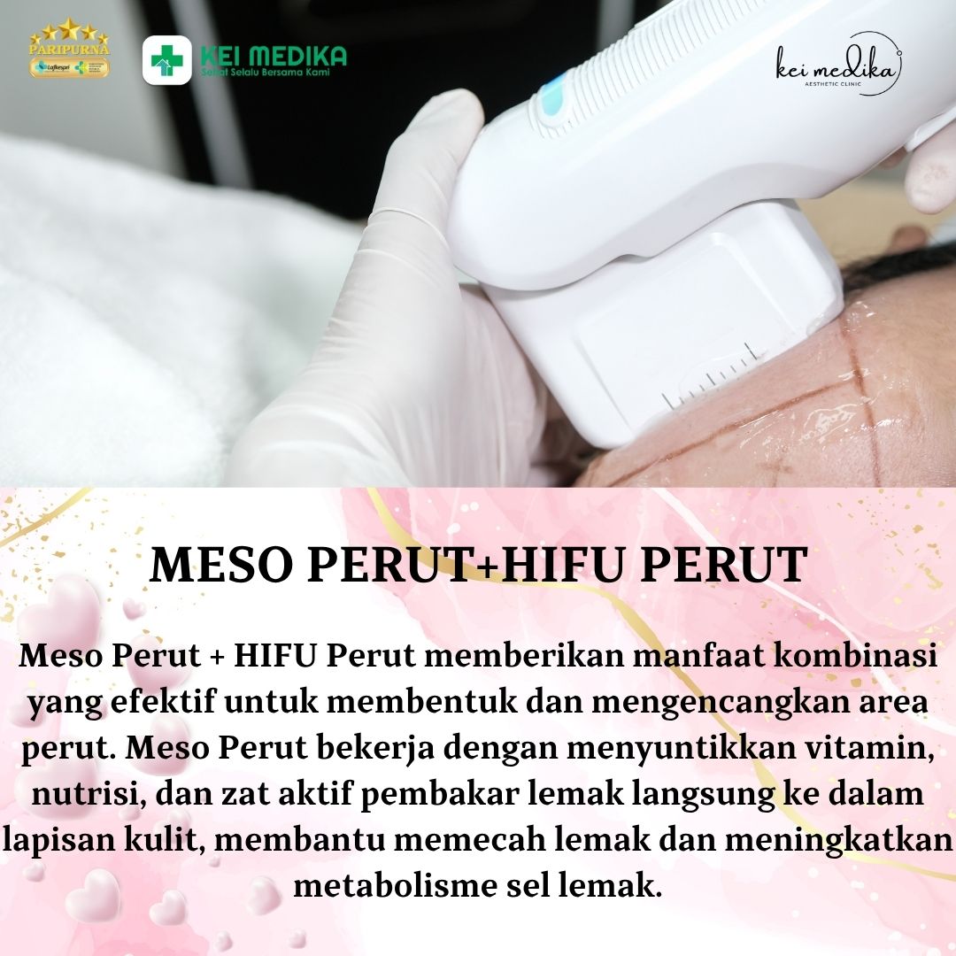 MESO PERUT+ HIFU PERUT