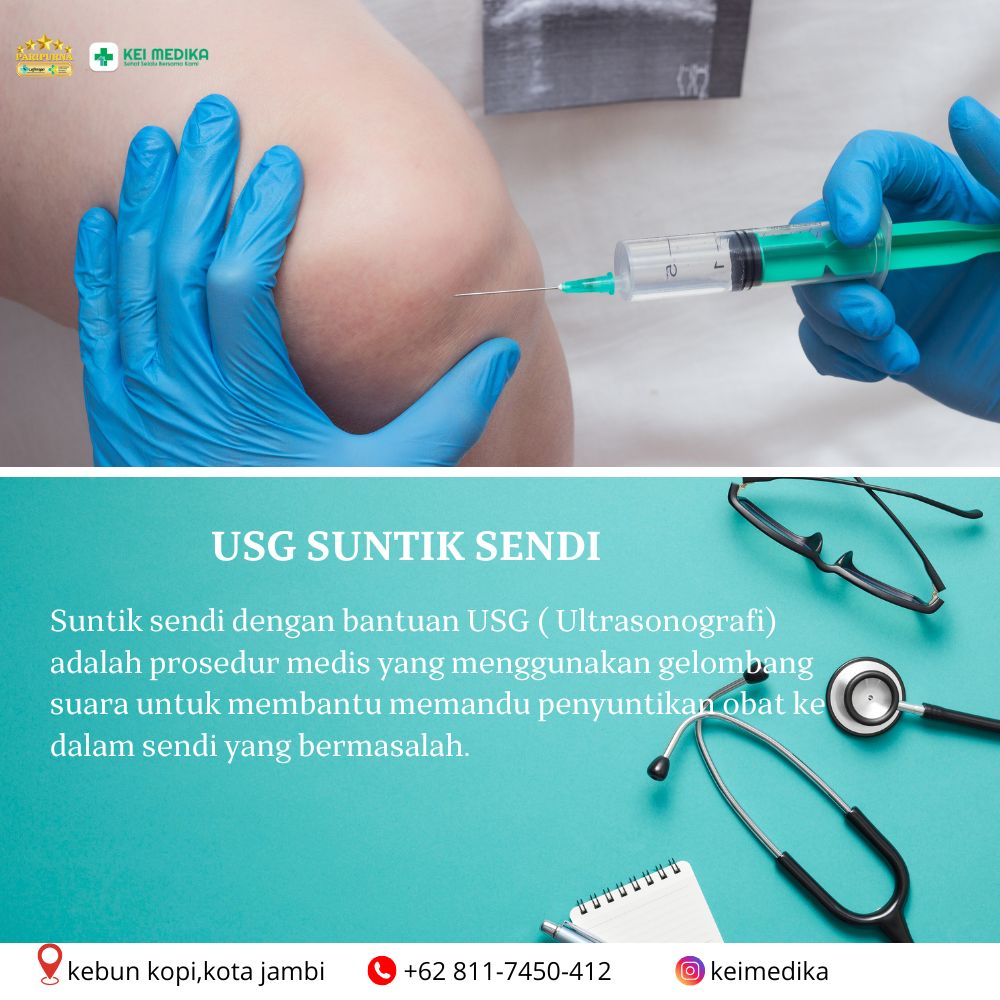 USG GUIDANCE 