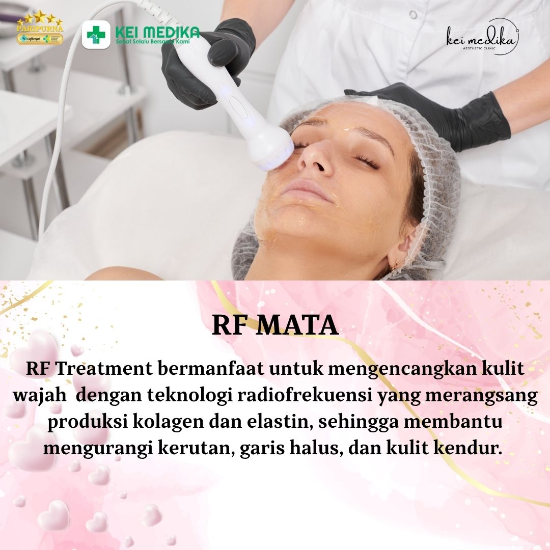 RF MATA