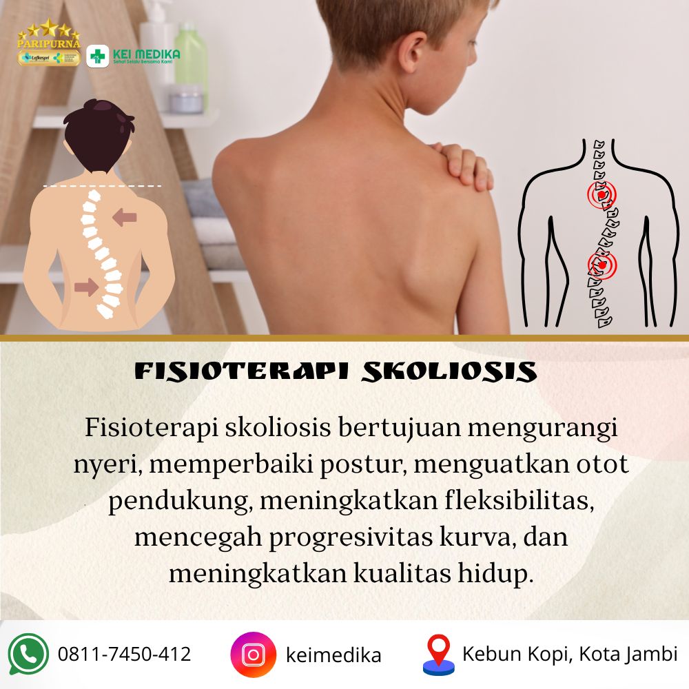 SKOLIOSIS 5 SESI 