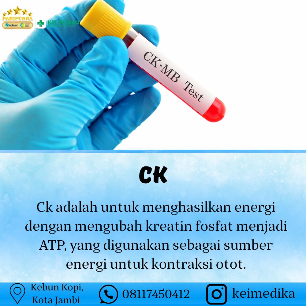 CK