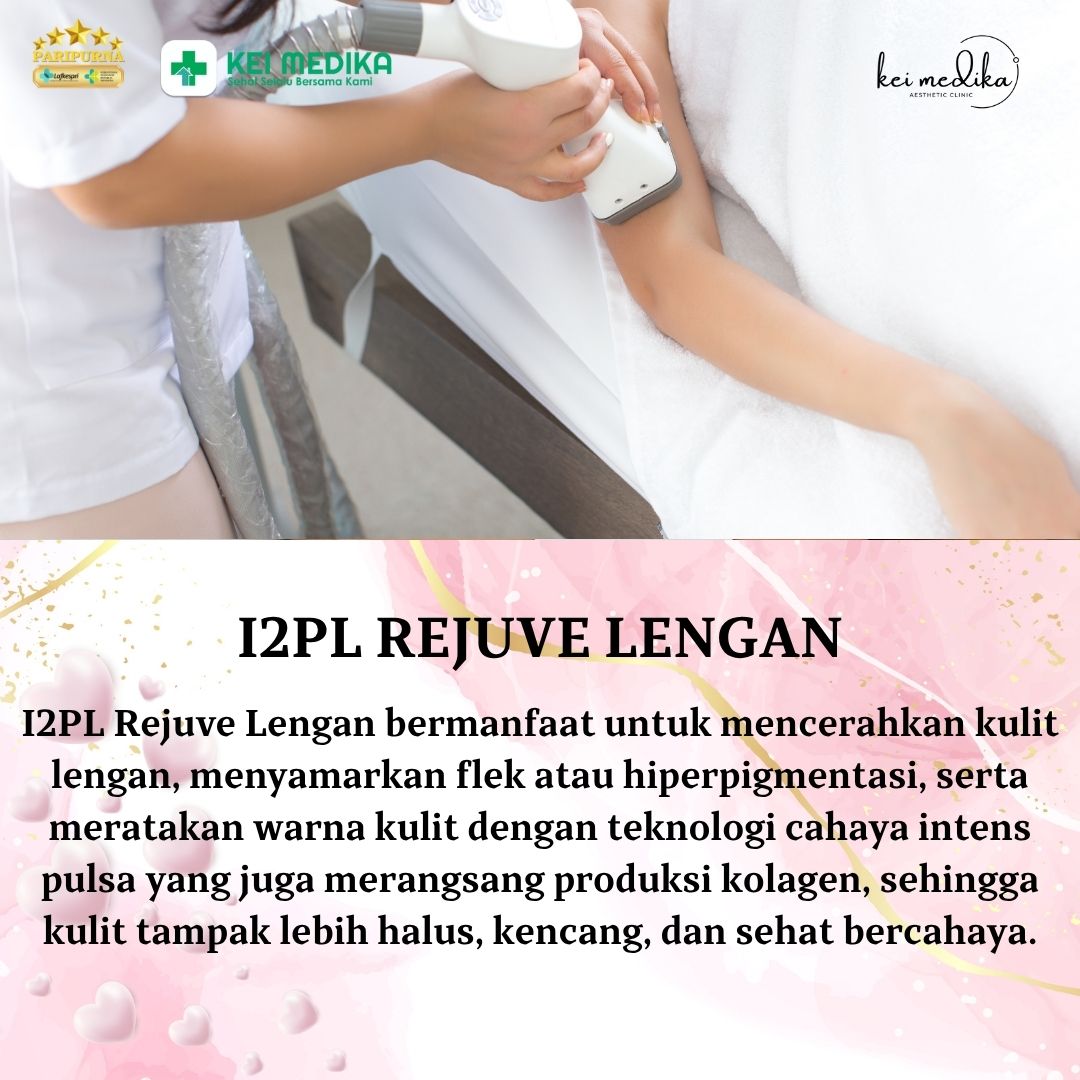 I2PL REJUVE LENGAN