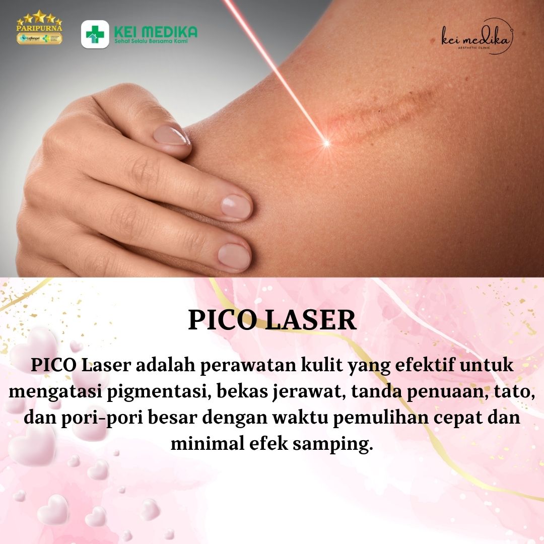PICO LASER