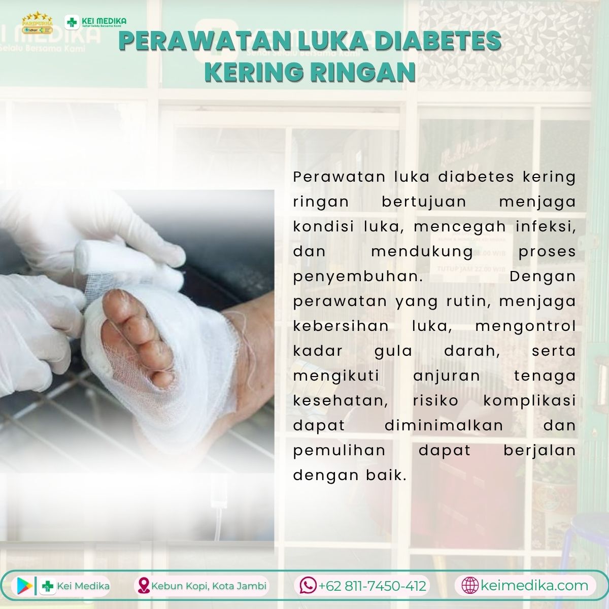  PERAWATAN LUKA DIABETES KERING RINGAN