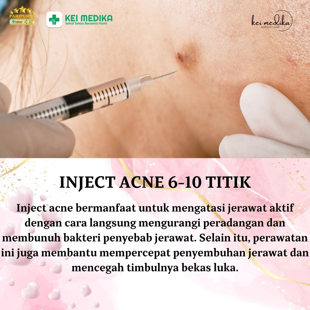 INJECT ACNE 6-10 TITIK