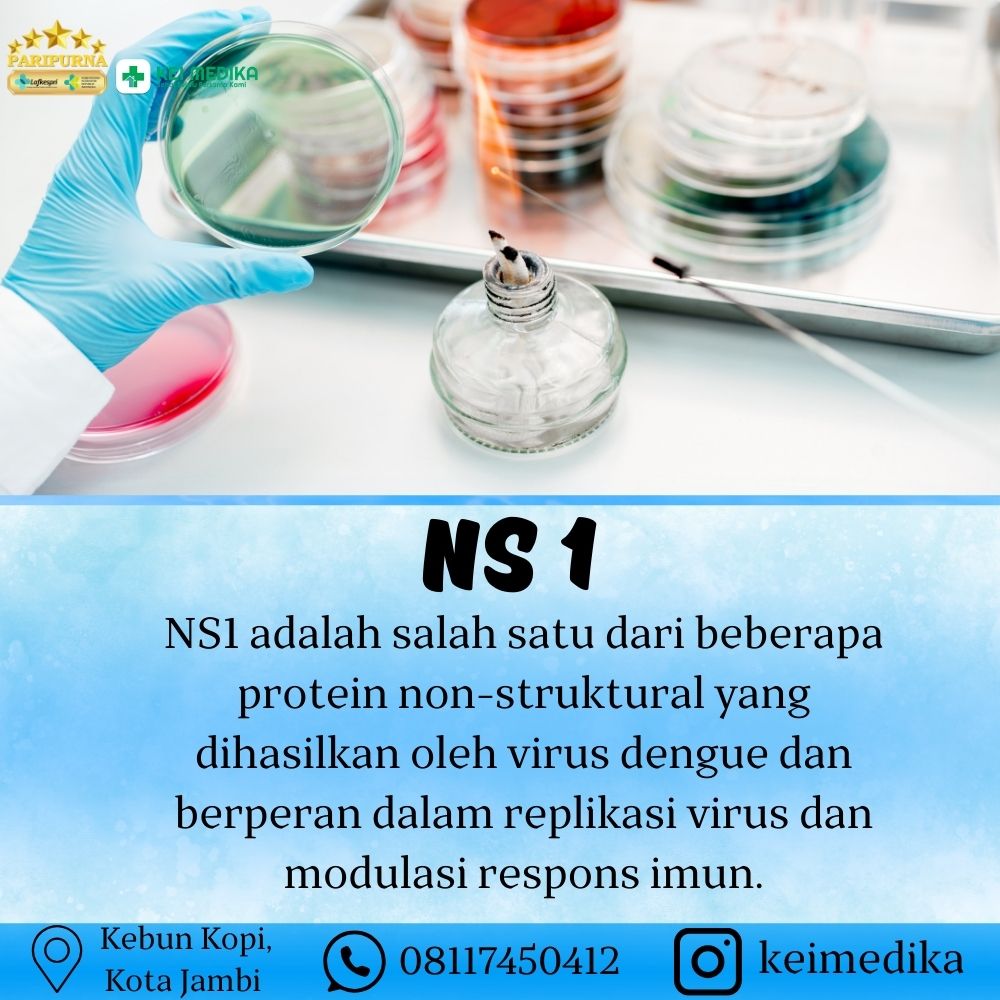 NS 1